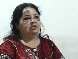 Help My Aunt Neeta Undergo An Operation