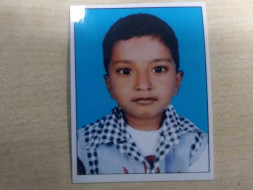 Help Akhil Survive Brain Damage