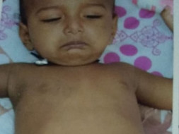 Help One Year Old Aiyan To Fight With Deadly Rare Gaucher Disease