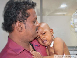 This 1-Year-Old Baby's Cancer Will Spread Rapidly Without Treatment