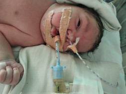 Help My Baby Boy Fight Respiratory Disease
