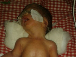 Help Ashok premature baby survive