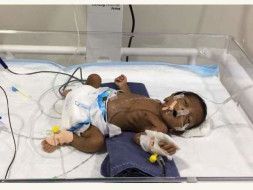 Help Premature Baby Of Ushakumari