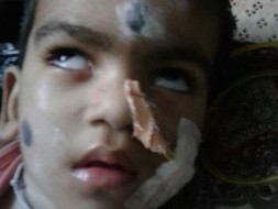 Help 3-Year-Old Sai Battles In The Hospital