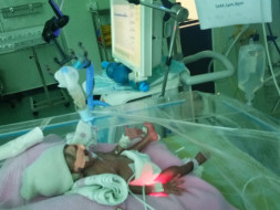 Help Me To Save My Premature Female Baby