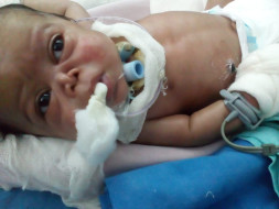 Support The Treatment Of Subhojit Jowardar