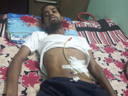 Help Mohd Jameeluddin SUffering From Dysphagia.