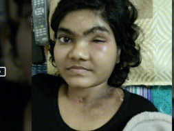 Help Pooja Undergo Her Second Surgery At The Earliest