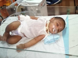 Help My Newborn Baby Boy Fight Against Hie Gr.iii With Sepsis.