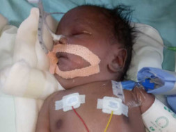 Help Baby of Riddhi Survive.