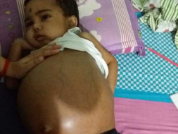 Help Save Little Prabal.
