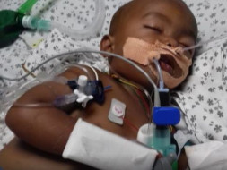 Help Rithwik fight Dengue - Multiple Organ Dysfunction