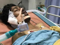 Help Balu Who Met With A Tragic Accident.