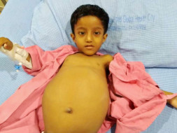 My son holds his stomach tight and cries out loudly in pain. He drains