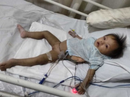 Save Rachel: HELP 10 month old baby from Manipur with fluid in Lungs.