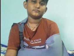 Help A 11-years Old Boy Struggling With Multiple Shoulder Dislocation