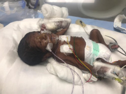 Help Prematurely Born Baby Fighting For Life.