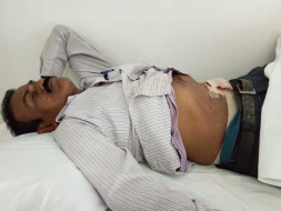 Help Manjunath Undergo Surgery