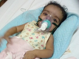 Help Shalini's Baby Undergo A Life Saving Surgery