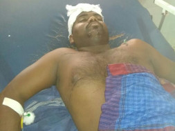 Fund Raising For Manikandan Brain Surgery