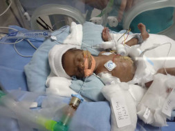 Help my premature baby who is struggling in ICU
