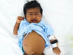 Support Baby Abhinand To Undergo a Liver Transplant