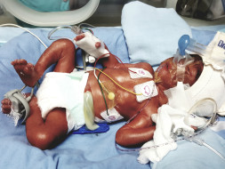 Help prematurely Born Baby Fighting For Life