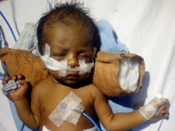Help Baby Of Rekha Fight Battles In The Hospital.