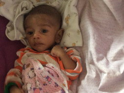 Please Help Me To Save My 3 Month Old Baby With 2 Holes In His Heart