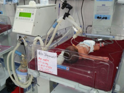 Save Newly Born Baby Suffering From Severe Lung Disease.