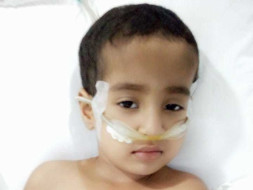 Baby Surabhi 3 Years Old Suffering From Pneumonia And Emhyma