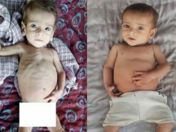 You can save lives of 500 malnourished children in Rajasthan!
