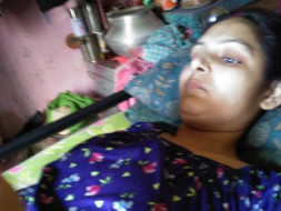 Fighting With NMOSD For My Wife Manju Shaw