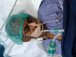Help My 53 Yr Old Dad Who Is Suffering From Brain Hemorrhage