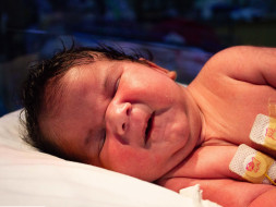 15-day-old baby with hole in the back needs urgent surgery