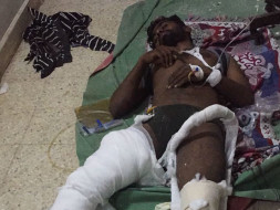 My close friend met with an accident, in a critical please help