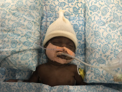 Help Mr & Mrs. Shobarani To Save Their Only Surviving Twin