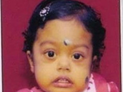 Help Baby Aaradhya to undergo Liver transplant surgery