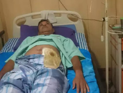 He Abdur Rashid Get A Liver Surgery.