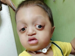 Let’s Help This Baby To Lead His Life - Muhammad Ibrahim