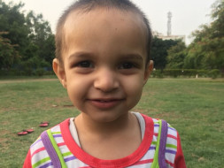 One-year-old Baby Shanaya is Undergoing Her Eye Tumor Operation.