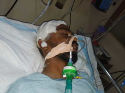 Help Saikiran Who Met With An Accident And Fighting For His Life.