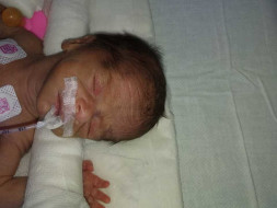 Seeking Financial Help for the Care of New-Born Twins in NICU