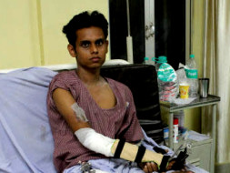 Aged Father Struggles To Save 21-Year-Old Who Already Lost His Leg