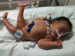 We will save her.... she’s just born!