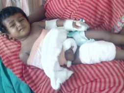 Help Mathulika To Get Her Right Hand