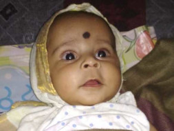 Help 5-month-old Baby Undergo Cataract Surgery A Heart Surgery