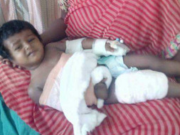 Help Little Madhulika Get A Hand