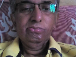 Help Me: Fighting Cancer For The 3rd Time
