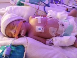 Help My Newborn Baby Girl Fight Congenital Heart Defect - HLHS